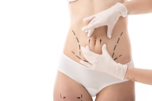 Targeted Fat Removal for Stubborn Areas