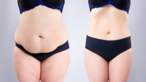 Before the Procedure: Your Preparation Phase