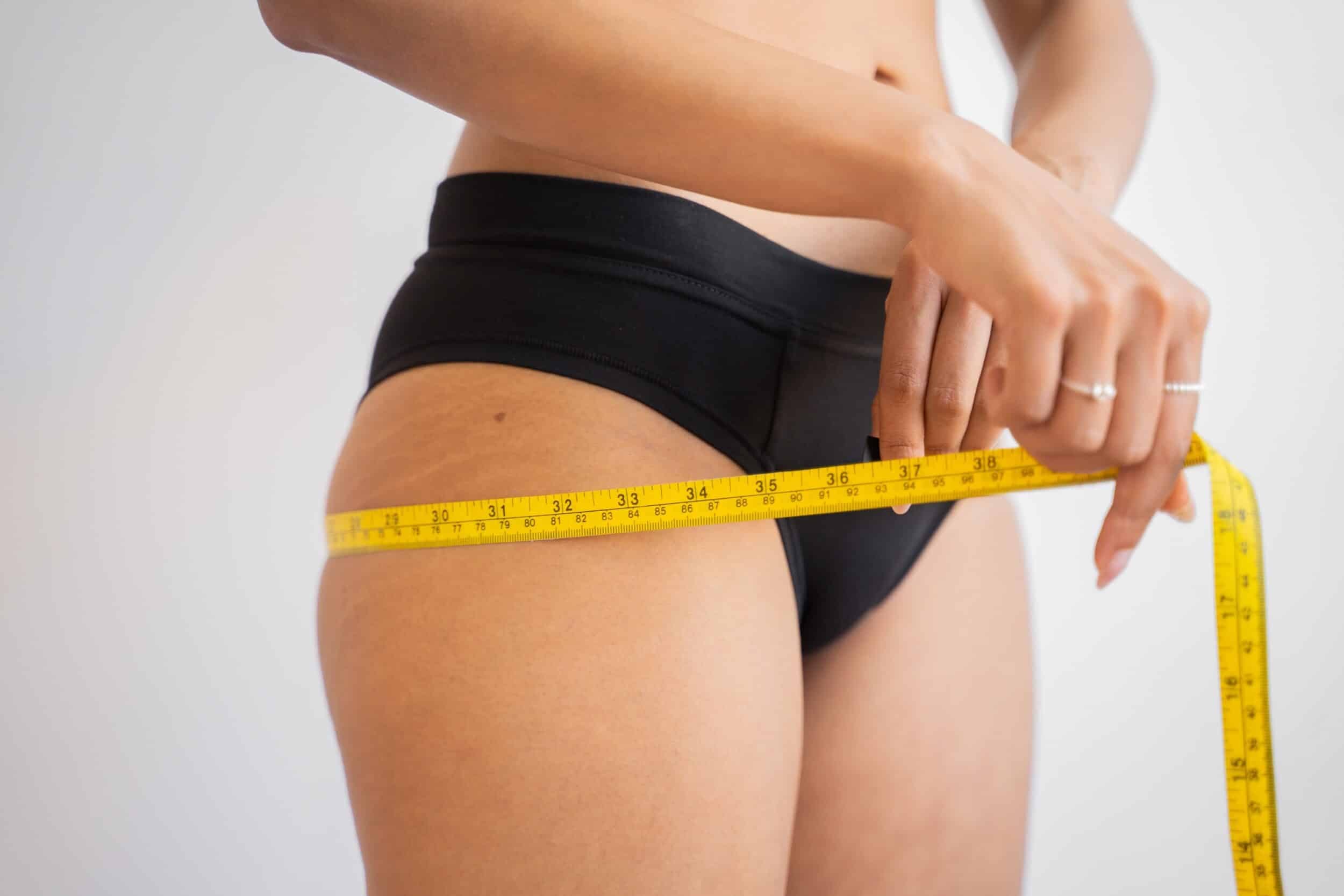 What To Expect During Recovery From a Thigh Lift